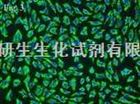 SP2/0（骨髓瘤细胞）