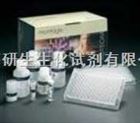人CD30分子（CD30）ELISA试剂盒